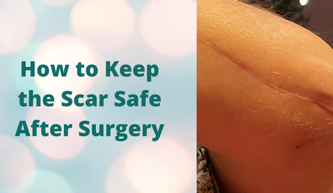 Surgery Vlog: Keeping the Scar Safe
