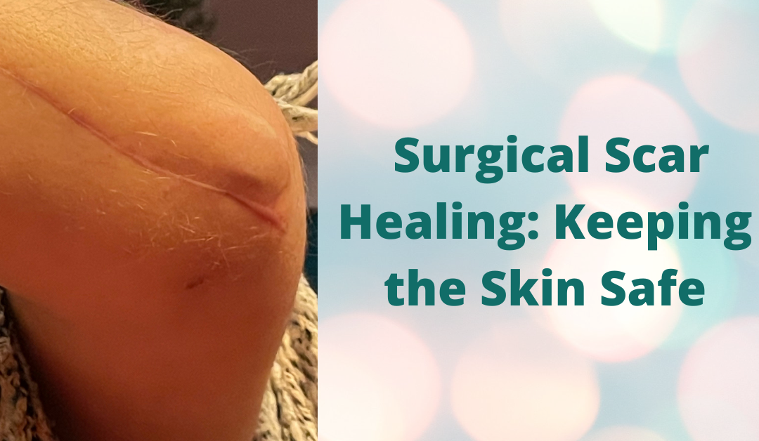 Surgical Scar Healing: Keeping the Skin Safe