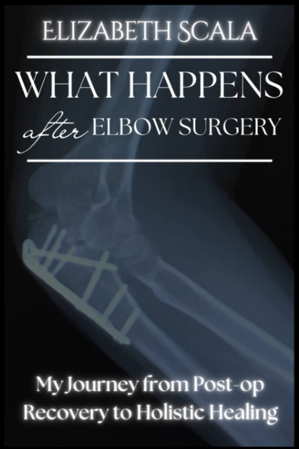What Happens after Elbow Surgery Book